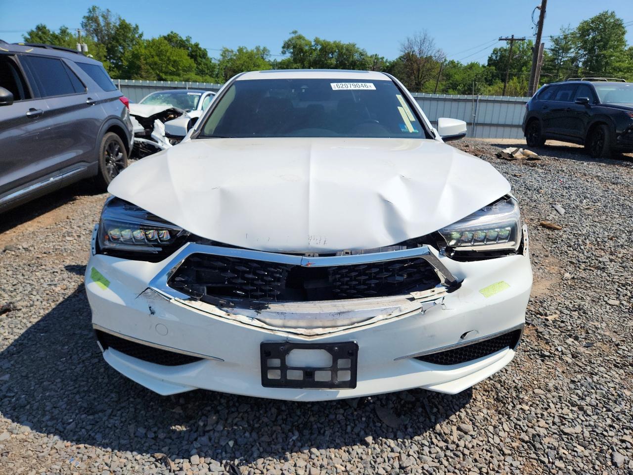 2018 ACURA TLX — снимка 5