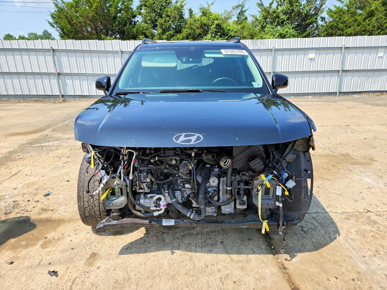2024 HYUNDAI SANTA FE XRT — снимка 5