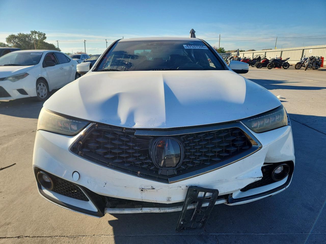 2018 ACURA TLX TECH+A — снимка 5