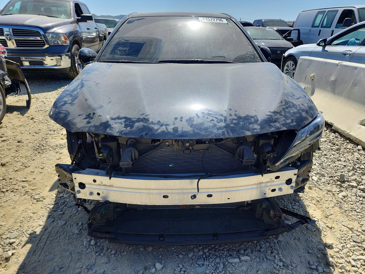 2024 TOYOTA CAMRY SE — снимка 5