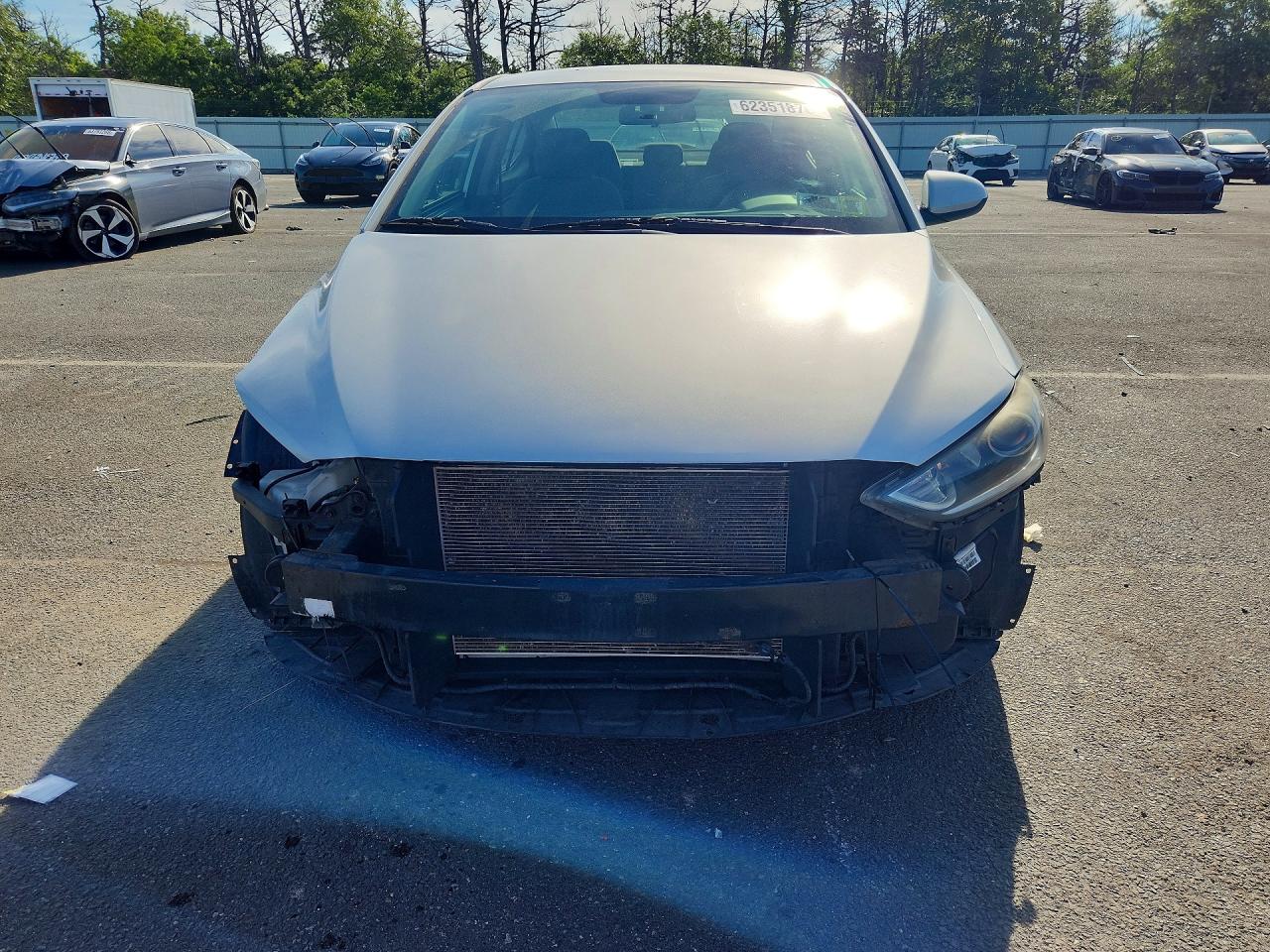 2017 HYUNDAI ELANTRA SE — снимка 5