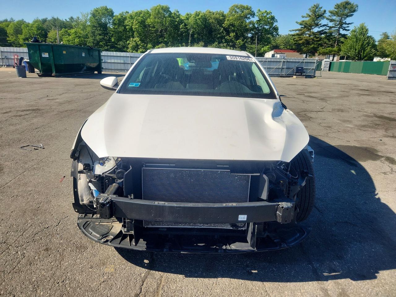 2024 KIA FORTE LXS — снимка 5