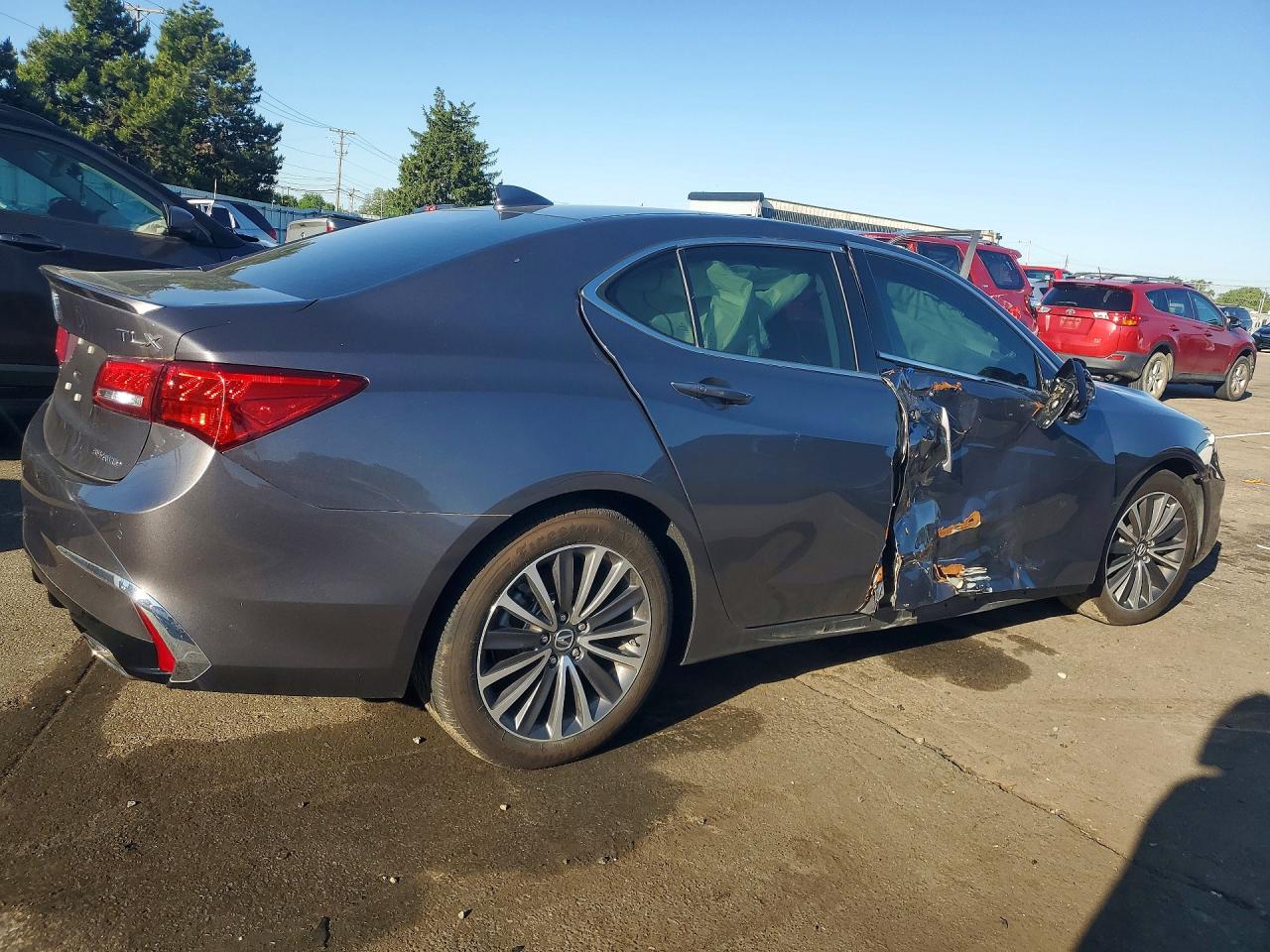 2018 ACURA TLX ADVANCE — снимка 3
