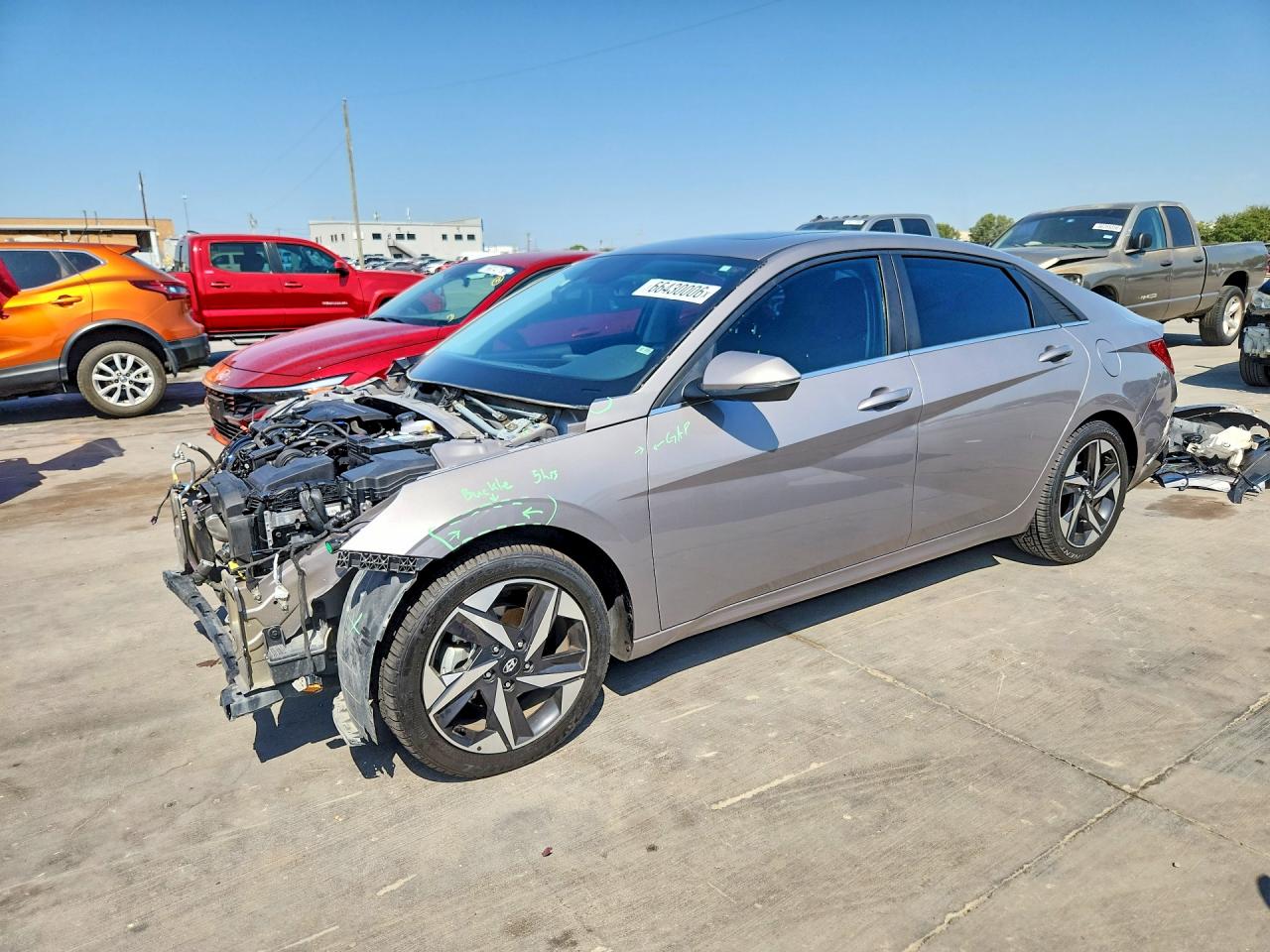 2022 HYUNDAI ELANTRA LIMITED