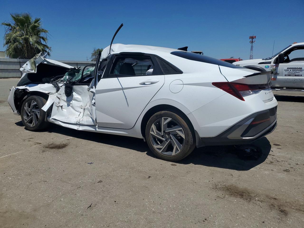 2025 HYUNDAI ELANTRA SEL SPORT — снимка 2