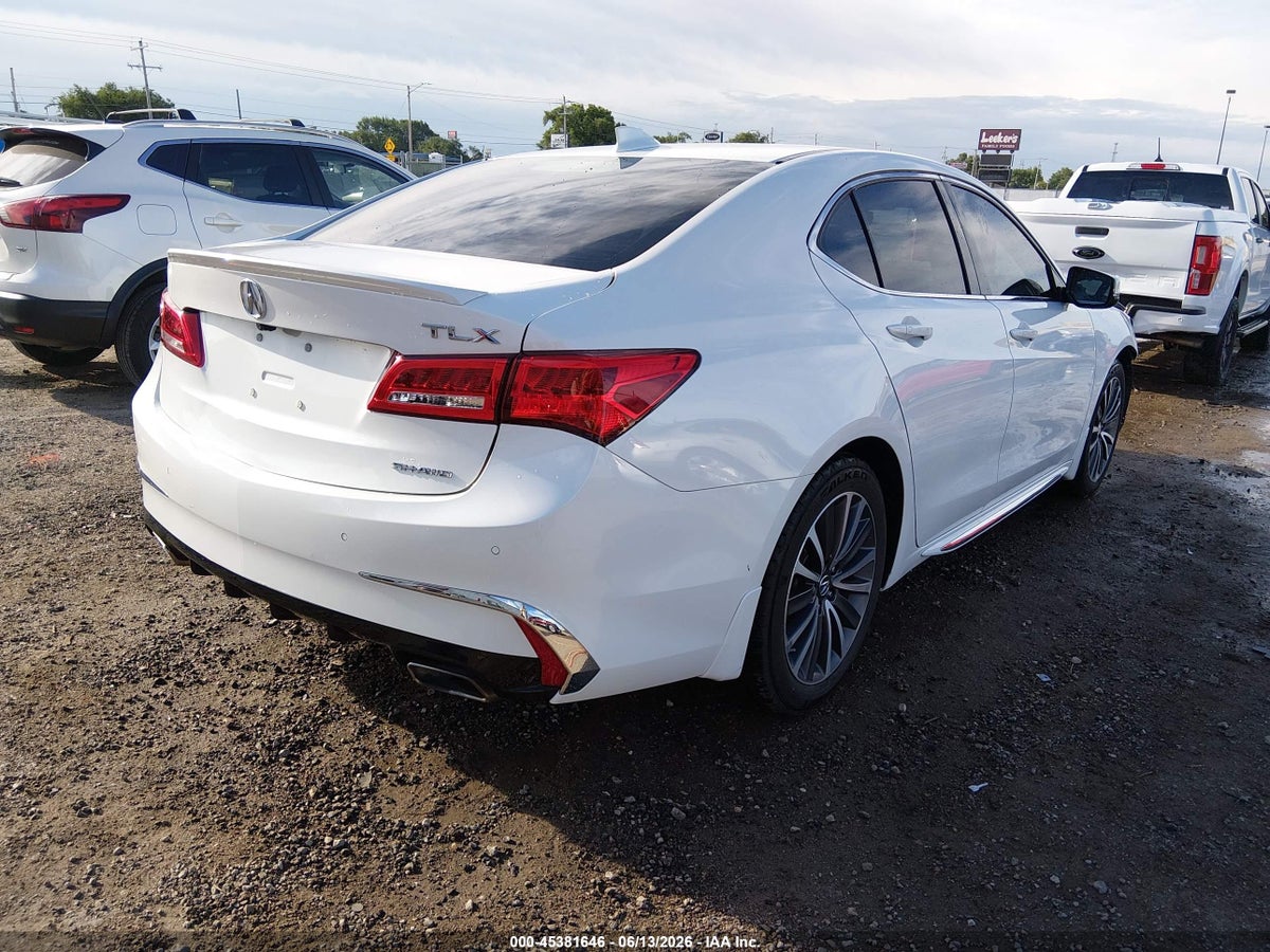 2018 ACURA TLX ADVANCE PKG — снимка 4